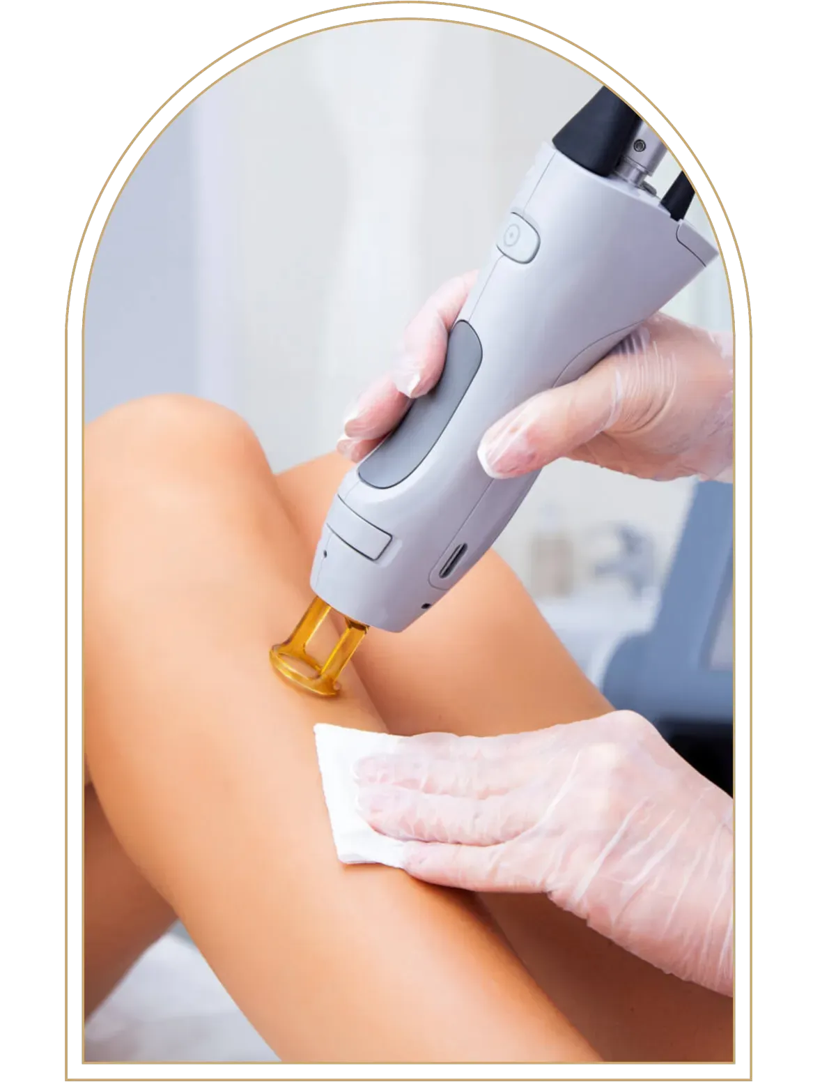 Laser Hair Removal