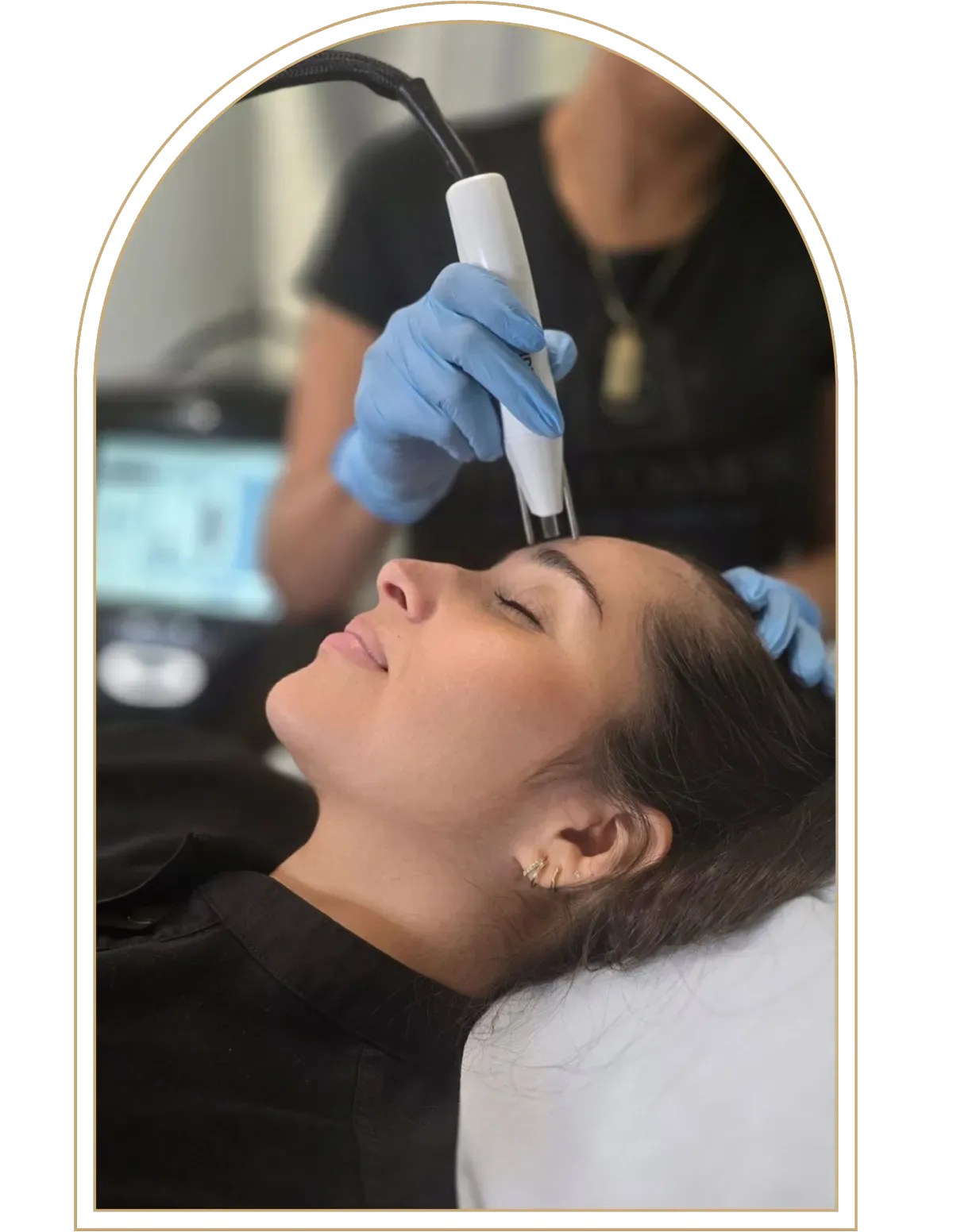 Pure Plasma Rejuvenation Treatment